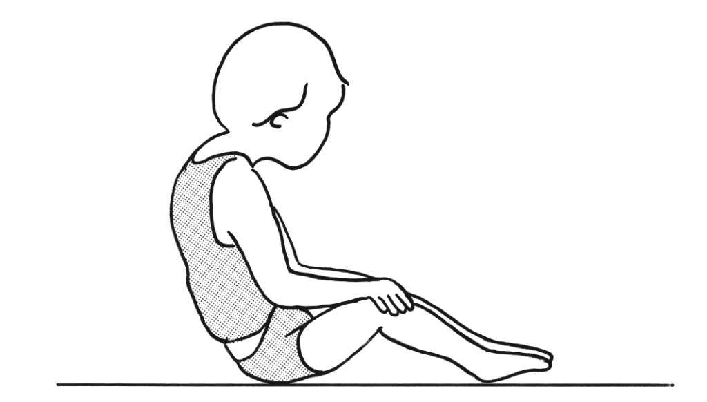9 図は痙直型両麻痺を示す脳性麻痺児 Gmfcsレベル の長座位姿勢である 後方に倒れるのを防ぐため上体を起こそうと全身の筋緊張を強め努力している その際に上肢に起こる連合反応として適切なのはどれか スタディメディマール