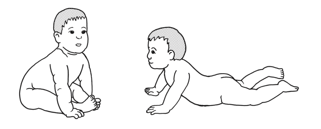 10 生後8か月の乳児 運動発達の遅れがあり 療育施設にて理学療法を受けている 図のような姿勢を示す 優先して行う運動はどれか スタディメディマール